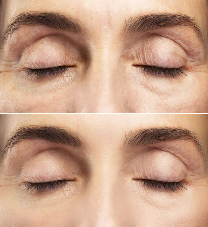 Intense Eye Revive - Special Offer - Image 4